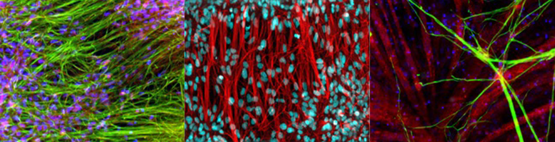 Human hiPSC Neurons (SMI312, Tuj1); (DAPI, Tuj1); and SMN neuromucular junction 