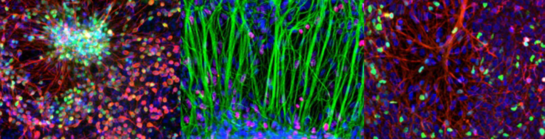 Human hiPSC Neurons  (NeuN, Tuj1); (Ki67, Tuj1, DAPI); (Tuj1, ISK1)
